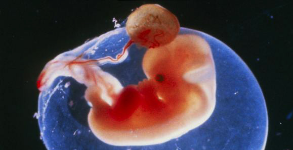 妊娠15周的孕妇须做心脏手术孕妇和胎儿安全是一场生死考验